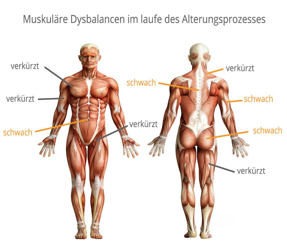 Zwei anatomische Darstellungen eines menschlichen Körpers zeigen die Muskulatur von vorne und hinten. Die Abbildung hebt bestimmte Muskelgruppen hervor und kennzeichnet sie mit Pfeilen und den Begriffen 'verkürzt' und 'schwach'. Die vorderen Oberschenkelmuskeln und Brustmuskeln sind als 'verkürzt' markiert, während die Bauchmuskeln und seitlichen Hüftmuskeln als 'schwach' bezeichnet werden. Auf der Rückseite sind die hinteren Oberschenkelmuskeln und Rückenmuskeln als 'verkürzt' gekennzeichnet, die Gesäßmuskeln und seitlichen Rückenmuskeln als 'schwach'. Oberhalb der Abbildungen steht der Titel 'Muskuläre Dysbalancen im laufe des Alterungsprozesses'.